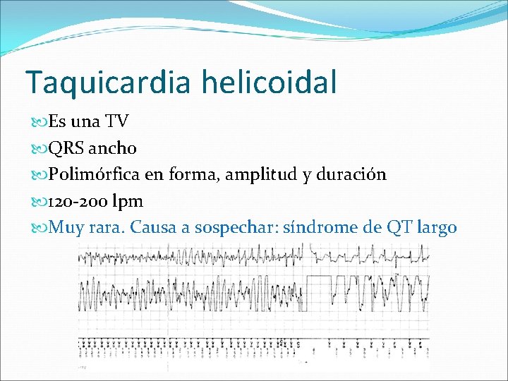 Taquicardia helicoidal Es una TV QRS ancho Polimórfica en forma, amplitud y duración 120