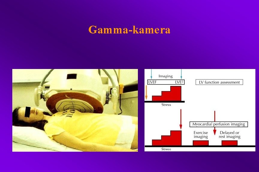 Gamma-kamera 