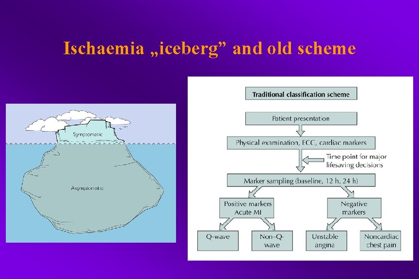 Ischaemia „iceberg” and old scheme 