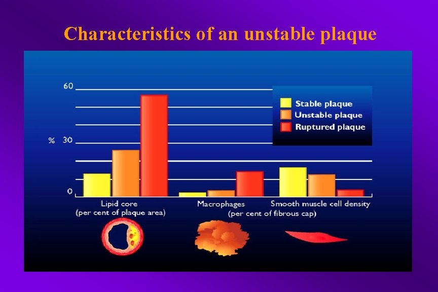 Characteristics of an unstable plaque 