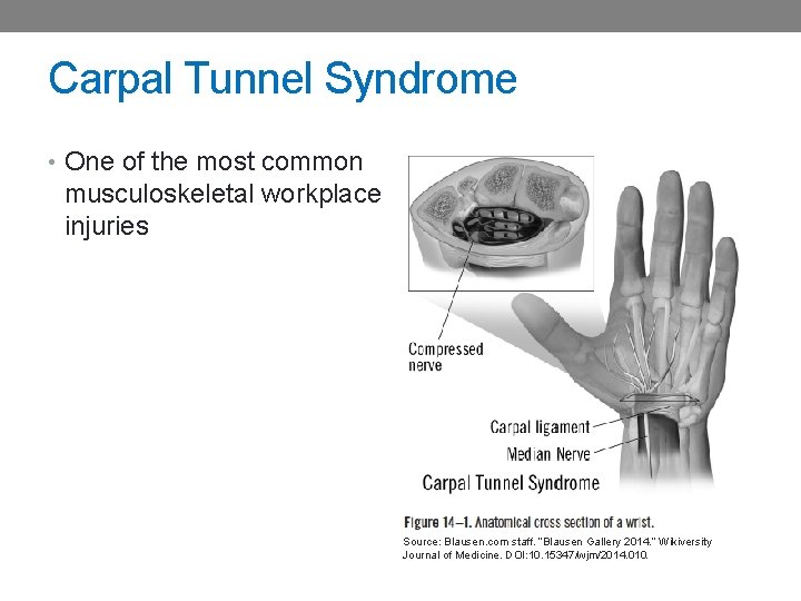 Carpal Tunnel Syndrome • One of the most common musculoskeletal workplace injuries Source: Blausen.