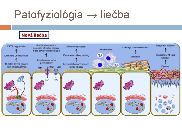 Patofyziológia → liečba Nová liečba 