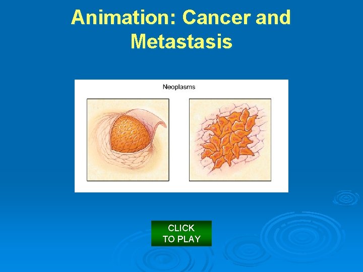 Animation: Cancer and Metastasis CLICK TO PLAY 