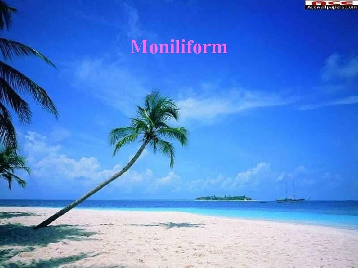 Moniliform 