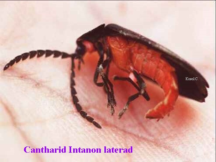 Kosol C. Cantharid Intanon laterad 