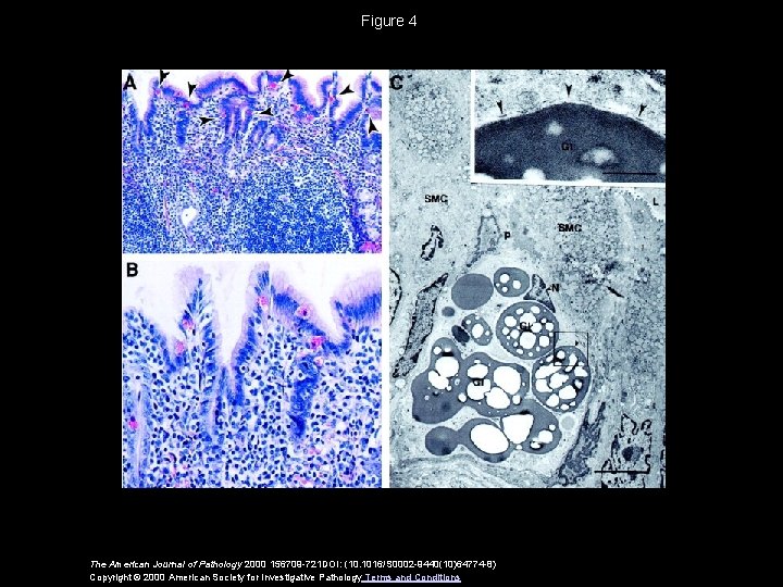 Figure 4 The American Journal of Pathology 2000 156709 -721 DOI: (10. 1016/S 0002