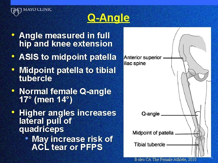 Q-Angle • Angle measured in full hip and knee extension • ASIS to midpoint