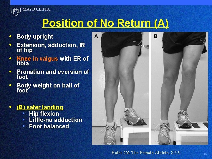 Position of No Return (A) • Body upright • Extension, adduction, IR • •
