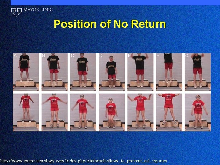 Position of No Return http: //www. exercisebiology. com/index. php/site/articles/how_to_prevent_acl_injuries 17 