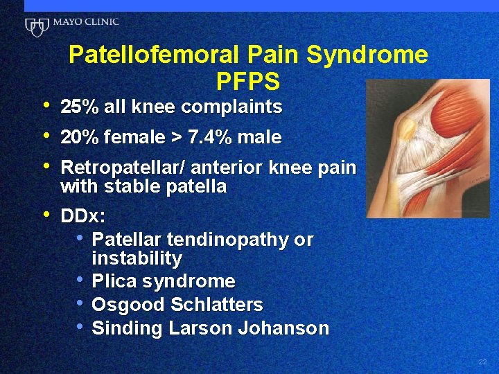  • • • Patellofemoral Pain Syndrome PFPS 25% all knee complaints 20% female