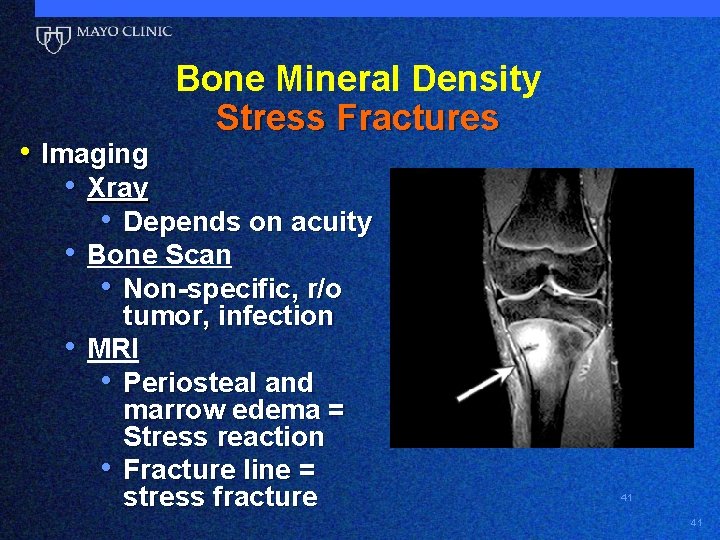 Bone Mineral Density Stress Fractures • Imaging • Xray • Depends on acuity •