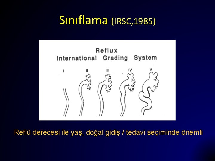 Sınıflama (IRSC, 1985) Reflü derecesi ile yaş, doğal gidiş / tedavi seçiminde önemli 