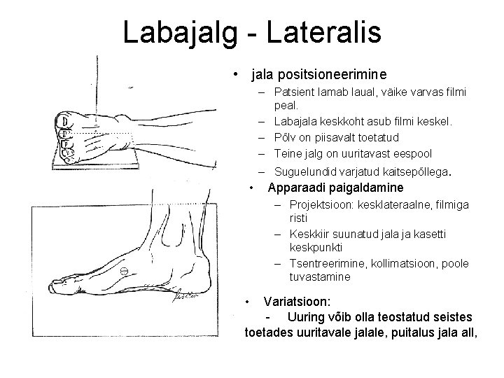 Labajalg - Lateralis • jala positsioneerimine – Patsient lamab laual, väike varvas filmi peal.