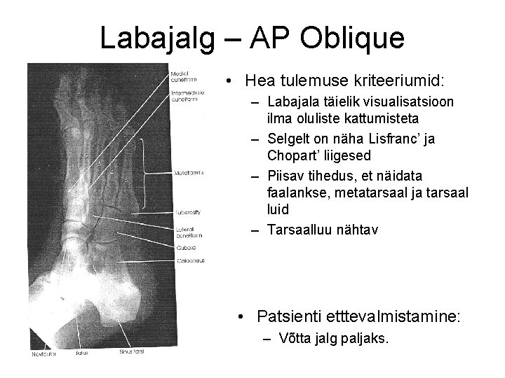 Labajalg – AP Oblique • Hea tulemuse kriteeriumid: – Labajala täielik visualisatsioon ilma oluliste