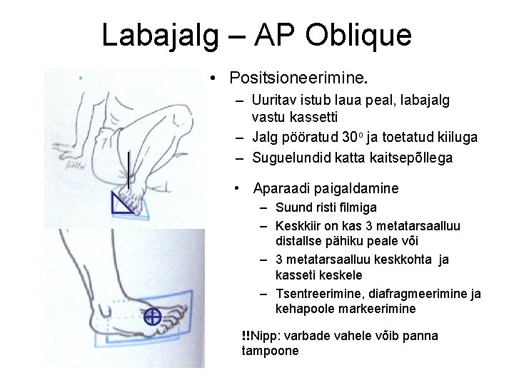 Labajalg – AP Oblique • Positsioneerimine. – Uuritav istub laua peal, labajalg vastu kassetti