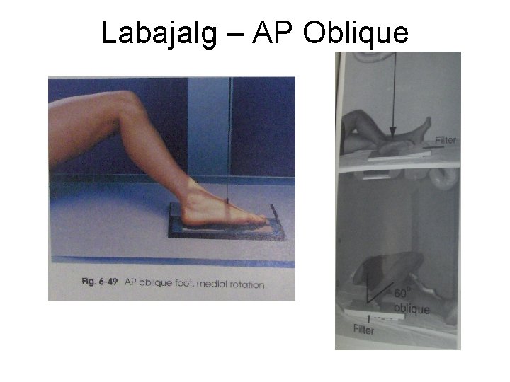 Labajalg – AP Oblique 