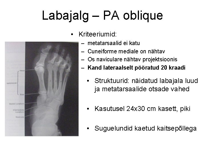 Labajalg – PA oblique • Kriteeriumid: – – metatarsaalid ei katu Cuneiforme mediale on