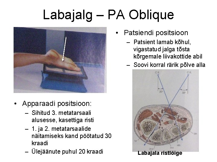 Labajalg – PA Oblique • Patsiendi positsioon – Patsient lamab kõhul, vigastatud jalga tõsta