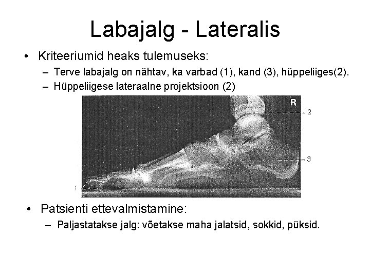 Labajalg - Lateralis • Kriteeriumid heaks tulemuseks: – Terve labajalg on nähtav, ka varbad