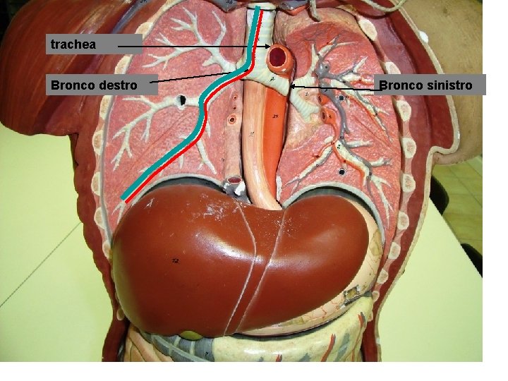 trachea Bronco destro Bronco sinistro 