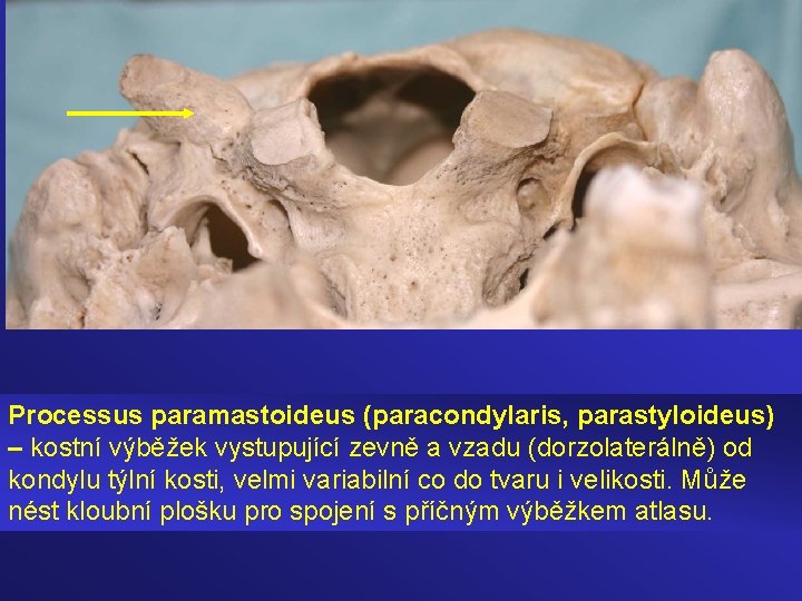 Processus paramastoideus (paracondylaris, parastyloideus) – kostní výběžek vystupující zevně a vzadu (dorzolaterálně) od kondylu
