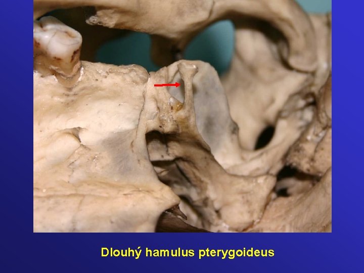 Dlouhý hamulus pterygoideus 