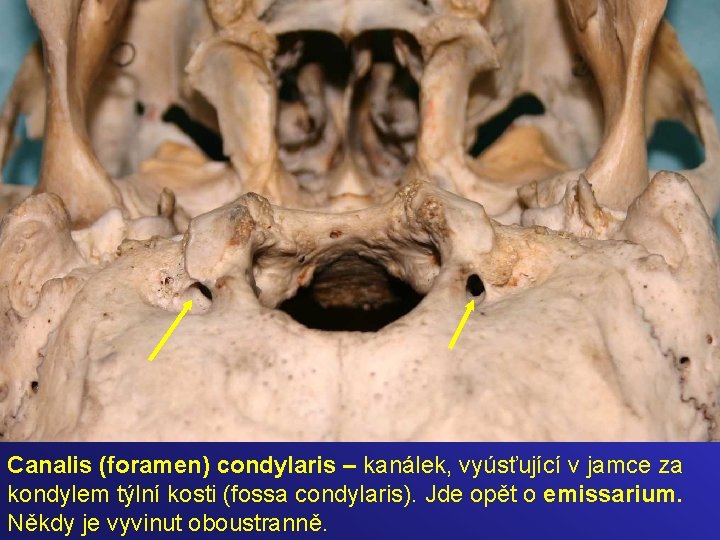 Canalis (foramen) condylaris – kanálek, vyúsťující v jamce za kondylem týlní kosti (fossa condylaris).