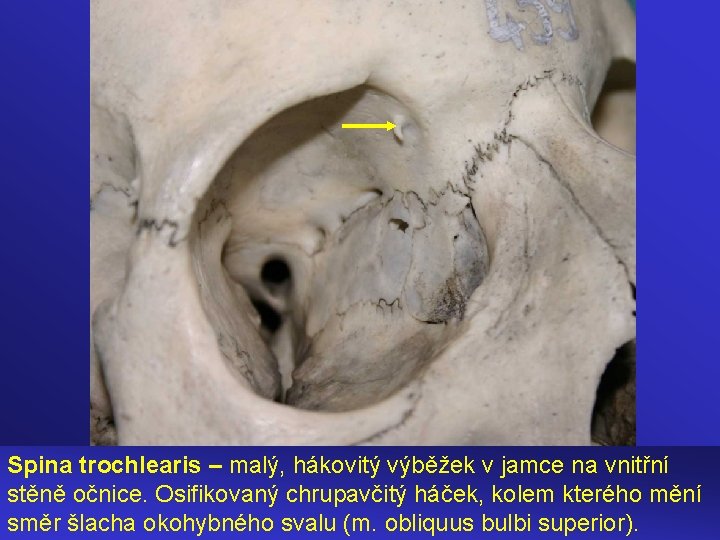 Spina trochlearis – malý, hákovitý výběžek v jamce na vnitřní stěně očnice. Osifikovaný chrupavčitý