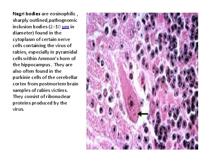 Negri bodies are eosinophilic , sharply outlined, pathognomic inclusion bodies (2– 10 μm in