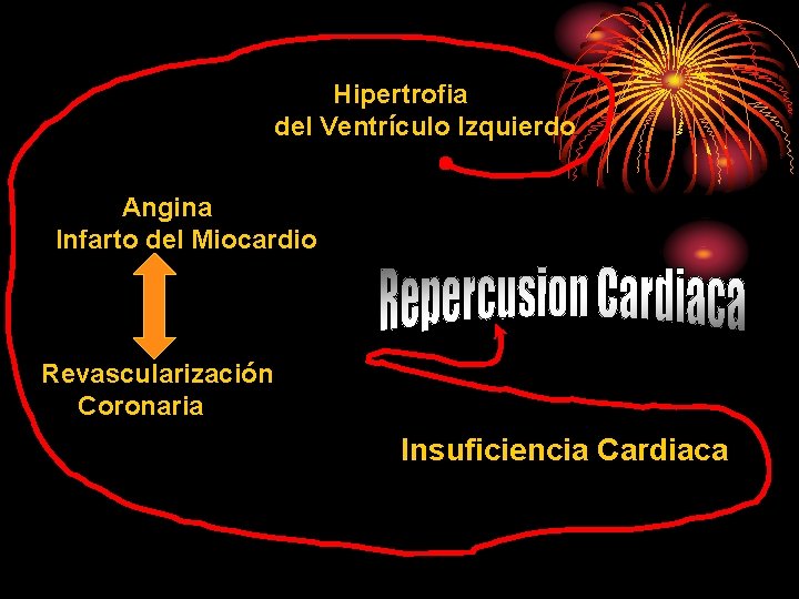 Hipertrofia del Ventrículo Izquierdo Angina Infarto del Miocardio Revascularización Coronaria Insuficiencia Cardiaca 