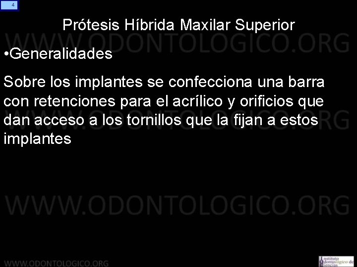 4 Prótesis Híbrida Maxilar Superior • Generalidades Sobre los implantes se confecciona una barra