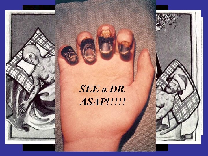 SEE a DR. ASAP!!!!! 