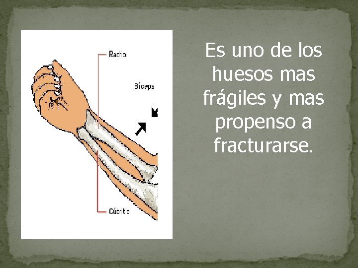 Es uno de los huesos mas frágiles y mas propenso a fracturarse. 