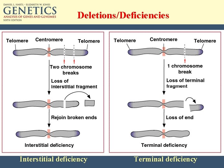 Deletions/Deficiencies Interstitial deficiency Terminal deficiency 