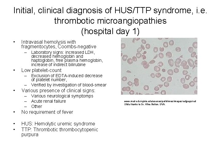 Initial, clinical diagnosis of HUS/TTP syndrome, i. e. thrombotic microangiopathies (hospital day 1) •
