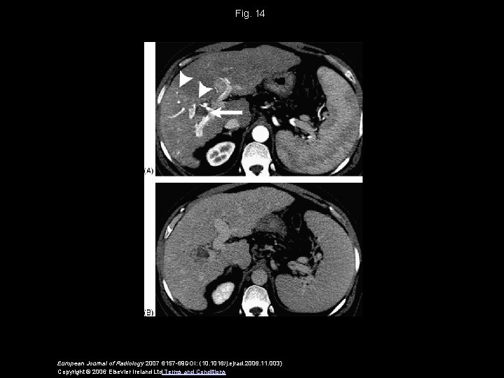 Fig. 14 European Journal of Radiology 2007 6157 -69 DOI: (10. 1016/j. ejrad. 2006.