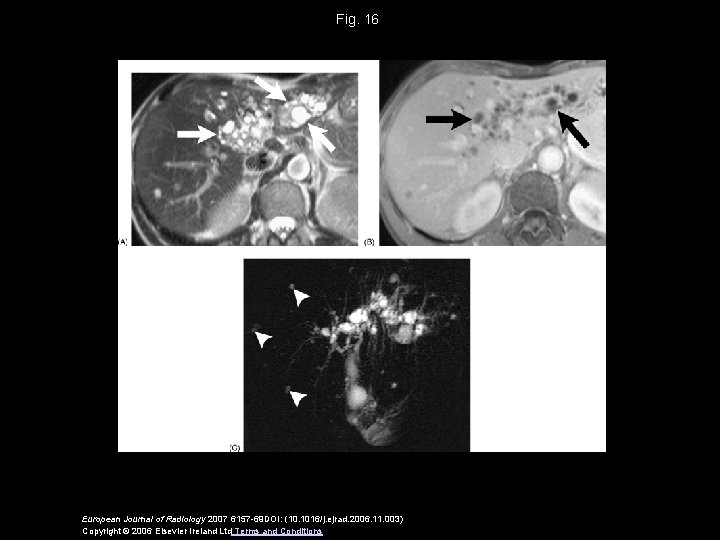 Fig. 16 European Journal of Radiology 2007 6157 -69 DOI: (10. 1016/j. ejrad. 2006.