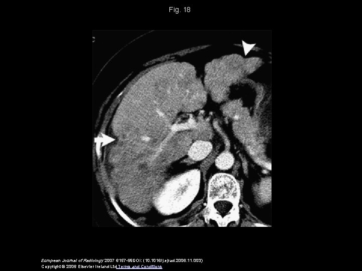 Fig. 18 European Journal of Radiology 2007 6157 -69 DOI: (10. 1016/j. ejrad. 2006.