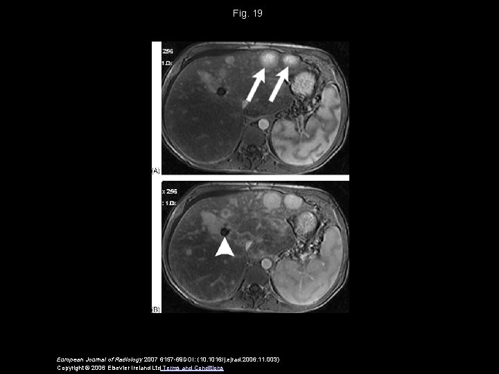 Fig. 19 European Journal of Radiology 2007 6157 -69 DOI: (10. 1016/j. ejrad. 2006.