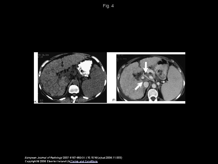 Fig. 4 European Journal of Radiology 2007 6157 -69 DOI: (10. 1016/j. ejrad. 2006.