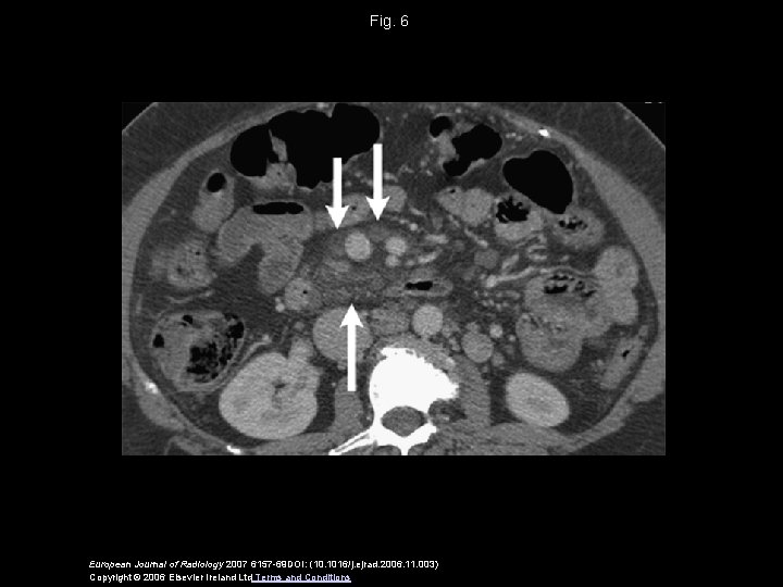 Fig. 6 European Journal of Radiology 2007 6157 -69 DOI: (10. 1016/j. ejrad. 2006.