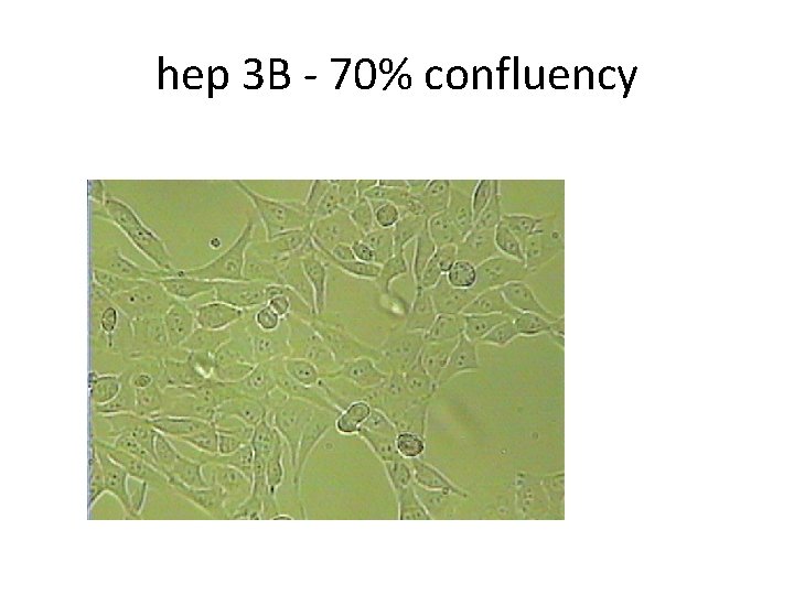 hep 3 B - 70% confluency 