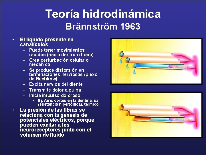 Teoría hidrodinámica Brännström 1963 • El liquido presente en canalículos – Puede tener movimientos