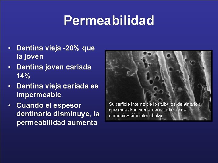 Permeabilidad • Dentina vieja -20% que la joven • Dentina joven cariada 14% •