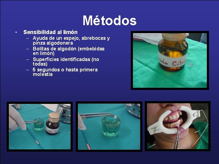 Métodos • Sensibilidad al limón – Ayuda de un espejo, abrebocas y pinza algodonera