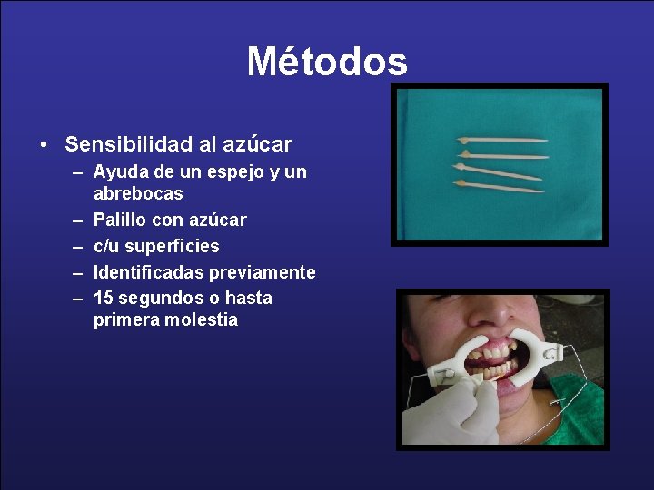 Métodos • Sensibilidad al azúcar – Ayuda de un espejo y un abrebocas –