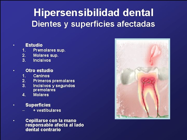 Hipersensibilidad dental Dientes y superficies afectadas • Estudio 1. 2. 3. • Otro estudio