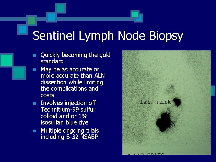 Sentinel Lymph Node Biopsy n n Quickly becoming the gold standard May be as