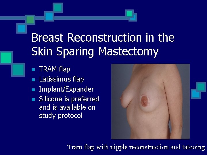 Breast Reconstruction in the Skin Sparing Mastectomy n n TRAM flap Latissimus flap Implant/Expander