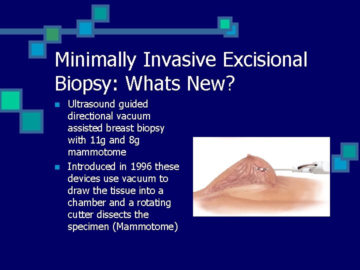 Minimally Invasive Excisional Biopsy: Whats New? n n Ultrasound guided directional vacuum assisted breast